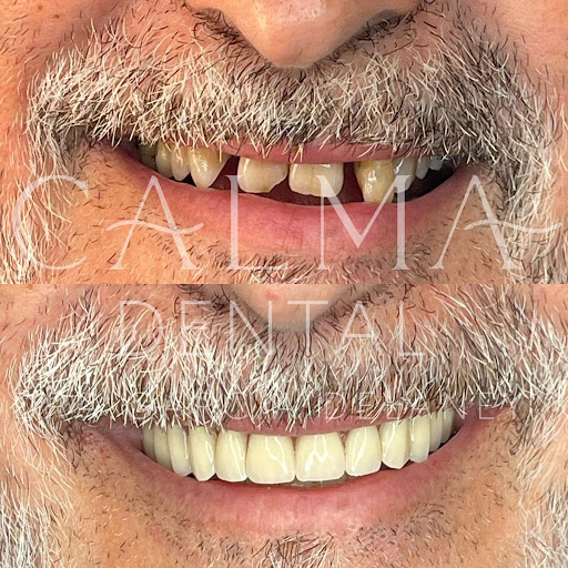 Clínica dental Calma Llíria - Thumbnail