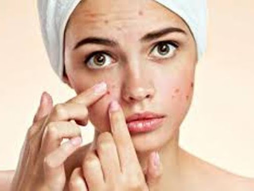 PIMPLE post image