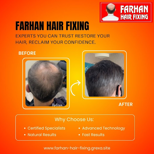 Benefits of Visiting a Hair Fall Clinic… post image