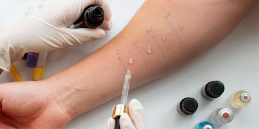Top Allergy Skin Test Center in Jaipur
