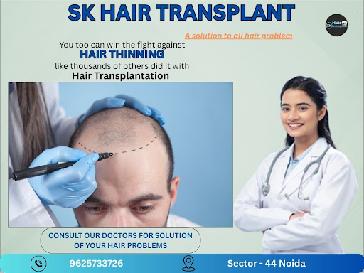 Welcome to SK Hair Transplant, the trusted destination for advanced hair transplant and hair rest… post image
