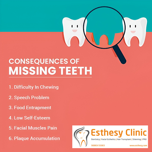 Did you know? 🤔 Missing teeth can affect more than just your smile! 😬 Restore your oral health an…