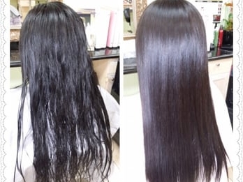 Laser hair removal @ 2499/-  post image