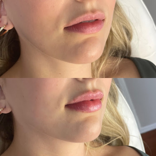 Injected by Bri - Thumbnail