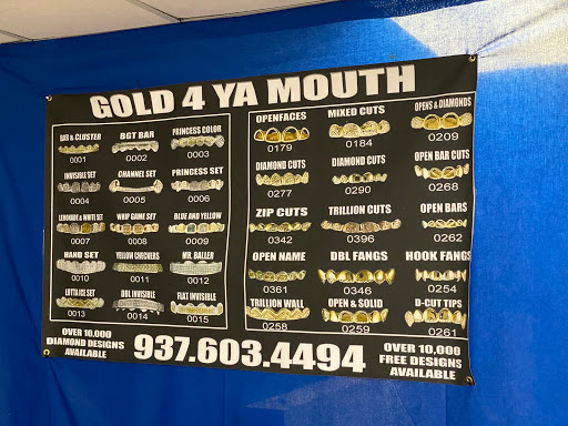 Gold 4 Ya Mouth - Thumbnail