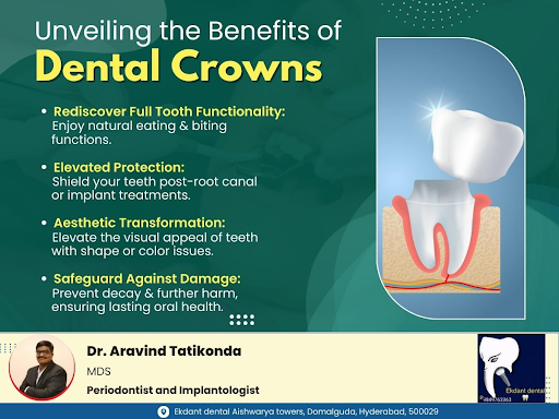 Benefits of Dental Crowns post image