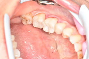 Photo n°5 de Dr Edouard COCQUEMPOT à Mametz (Dentiste)