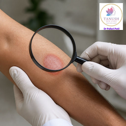 Struggling with itching, redness, or white patches on your skin? At Tanush Skin & Hair Clinic in… post image