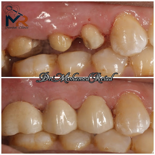 For U Dental clinic - صورة 5