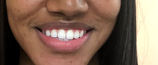 The Whitening Clinic - Thumbnail