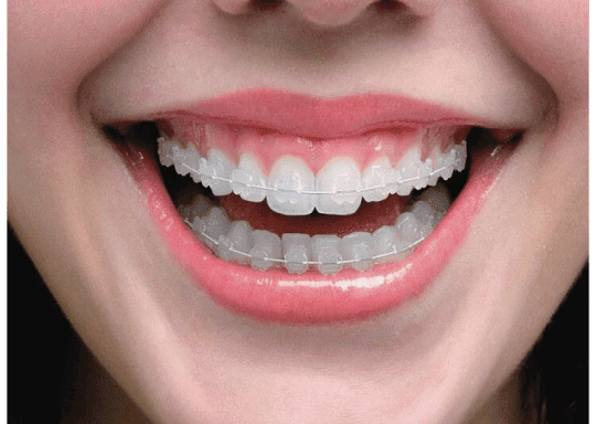 Smile Concepts Dental Clinic I Best Dental Clinic in Lokhandwala Andheri West by null
