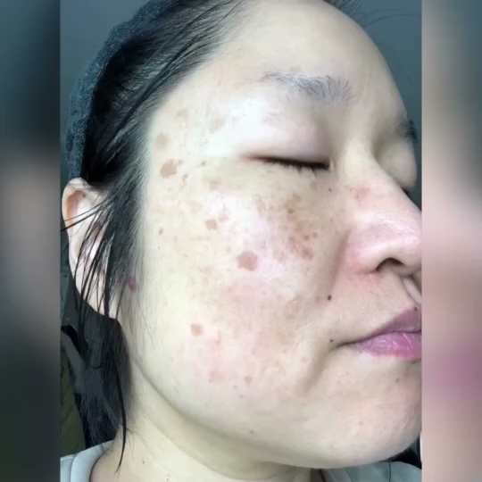 美顔専門店Brugge/ブルージュ