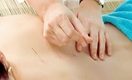 Acupuncture Specialists & Wellness Center