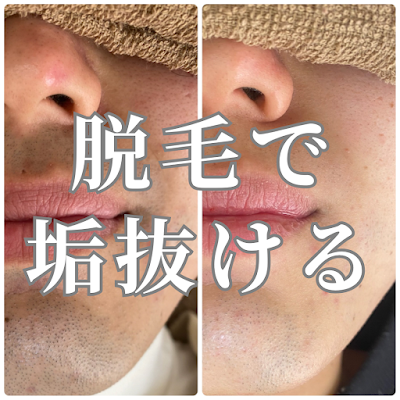 ACE. beauty salon 豊橋店