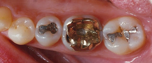 West LKN Dentistry, P.A. - Dental Implants Denver NC - Thumbnail