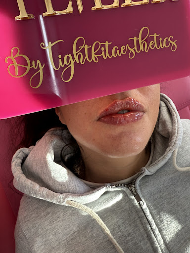 Tight Fit Aesthetics - Eyelashes East London