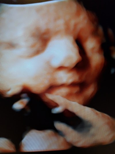 Sweet Baby Face hd 3d 4d ultrasound