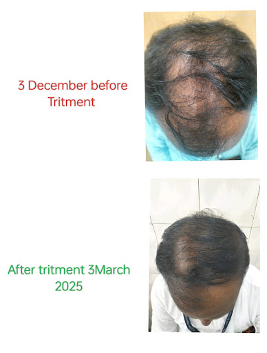 Hair disorders and other common conditions are diagnosed and treated... post image