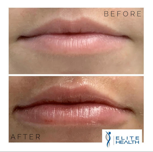 Thrive at Honolulu MedSpa