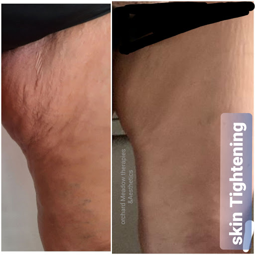 Orchard Meadow Therapies& Aesthetics - Thumbnail