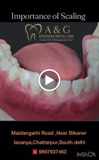 🦷 Professional Teeth Cleaning, Scaling & Polishing for a Healthier Smile post image