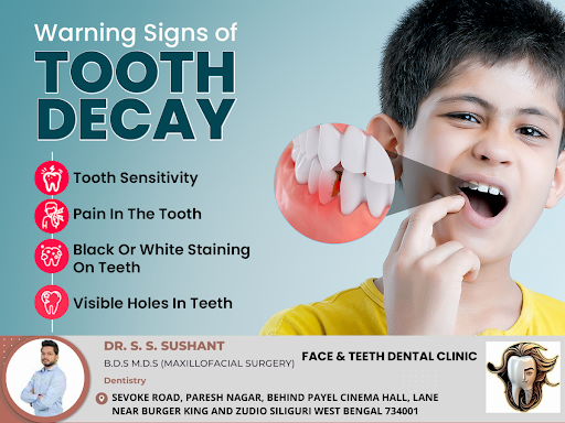 As tooth decay advances, it can manifest as more noticeable warning signs. These can include a pe… post image