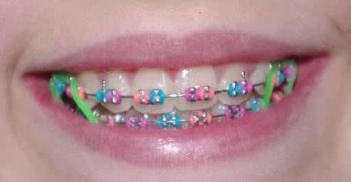 Century Orthodontics Wildwood Location - Thumbnail