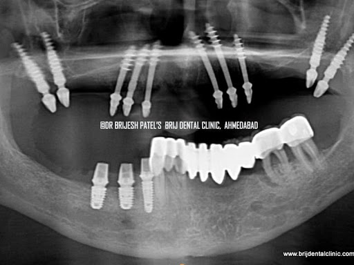 https://drarthsdentalcare.business.site/?utm_source=gmb&utm_medium=referral