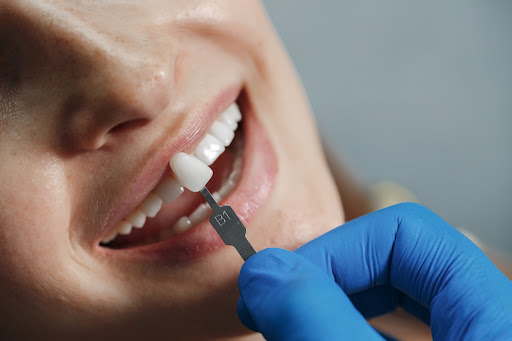 A dentist should assess tooth structure, bite, gum health, and overall oral condition before reco… post image