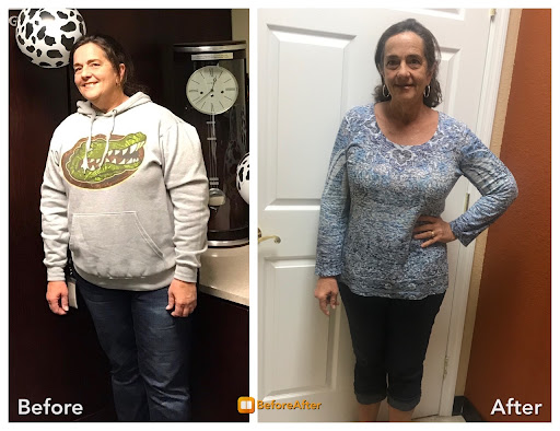 Advanced Skin & Weight Loss - Thumbnail