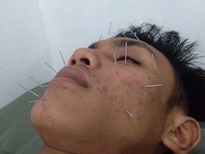 Photos of Griya Akupunktur Madura
