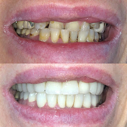 Photo n°4 de Clinadent - Centre dentaire Marseille 5 Sakakini à Marseille (Orthodontiste)