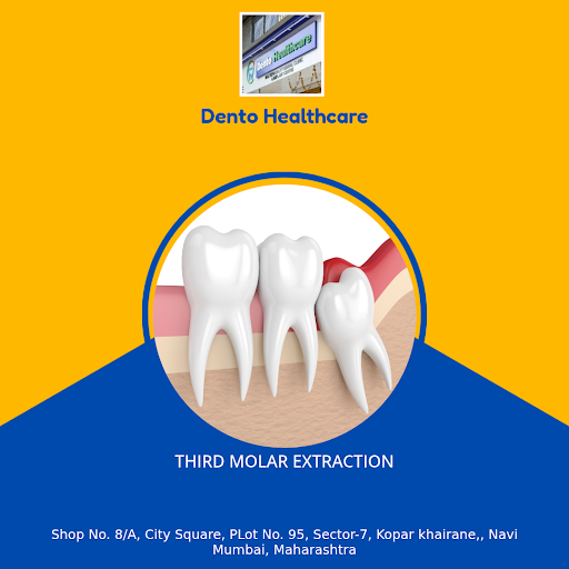 Visit Dento Healthcare in Navi Mumbai for expert third molar extraction. Trusted by locals, our s… post image