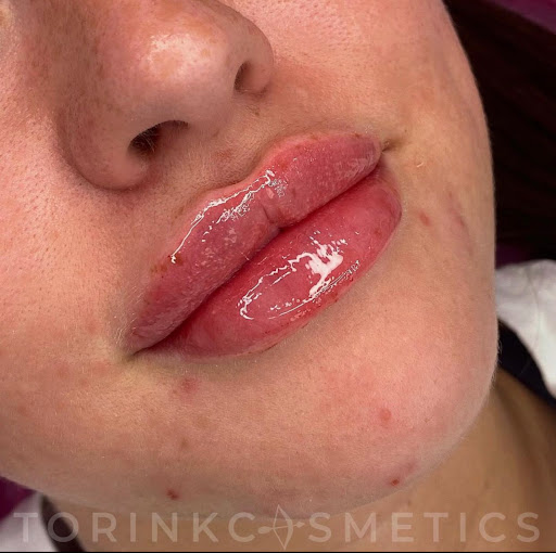 Torink Cosmetics & Aesthetics