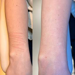 Photo n°5 de EXPERTE DERMOGRAPHE Yulia VALKOVICH à Paris (Service de détatouage)