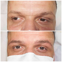 Photo n°19 de KOSM'INK à Lyon (Clinique de maquillage permanent)