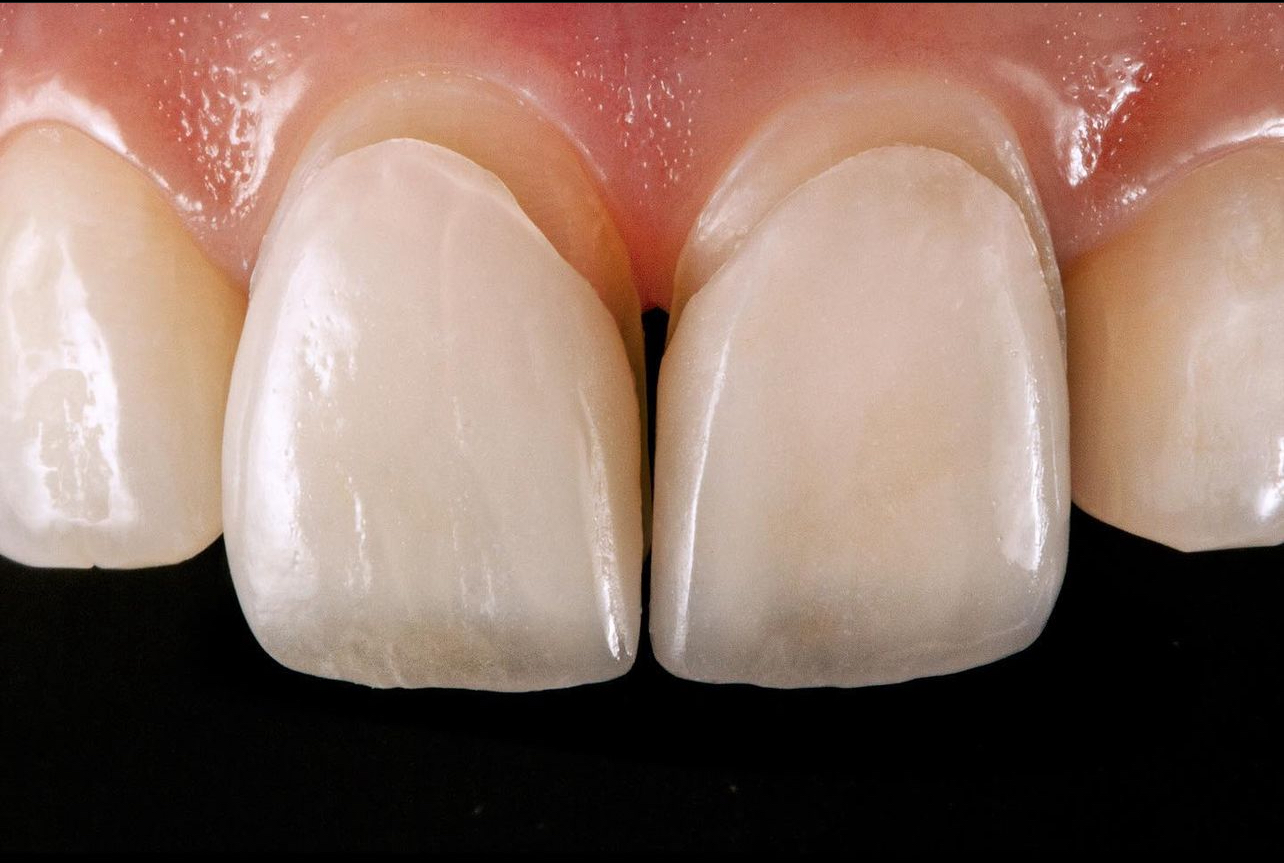 Harmony smile clinics عيادات هارموني سمايل كلينيك - صورة 2