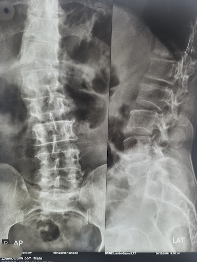 🩻 *Back pain is not just “age-related” — your spine tells a story.*