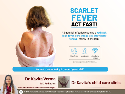Scarlet fever is a bacterial infection that causes a red rash, high fever, sore throat, and a str… post image