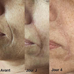 Photo n°18 de Jera Esthetic Concept à Bormes-les-Mimosas (Institut de beauté)