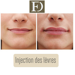 Photo n°18 de Dr Franck Ouakil, chirurgien esthétique à Paris à Paris (Clinique de chirurgie plastique)