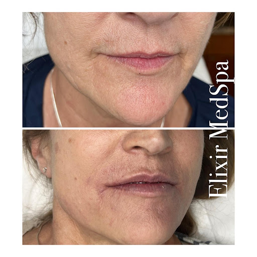 Elixir Med Spa - Visual