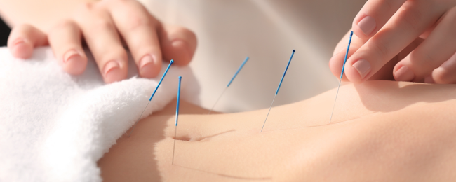 Acupunctuur Eindhoven & Best openingstijden