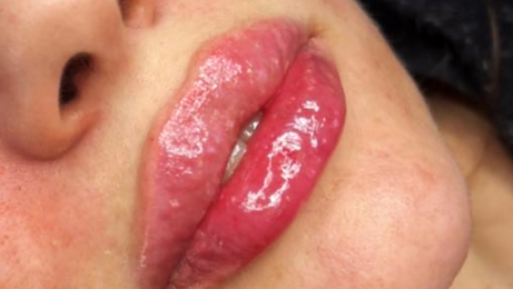 Shak Smith Aesthetics