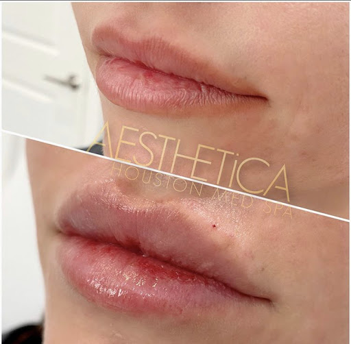 Aesthetica Houston Med Spa - Thumbnail