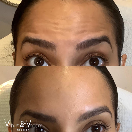 Venus & Venom MEDIspa Monroe - Thumbnail