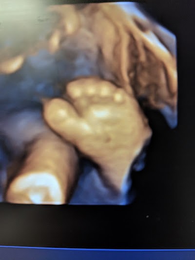 Sweet Baby Face hd 3d 4d ultrasound