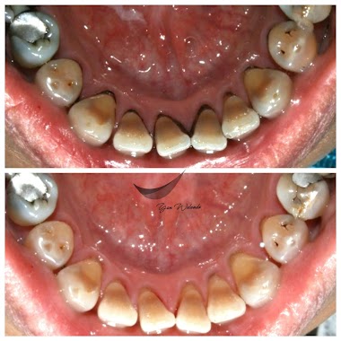 Drg Yan Walando (Glam Dental Studio), Author: Drg Yan Walando (Glam Dental Studio)