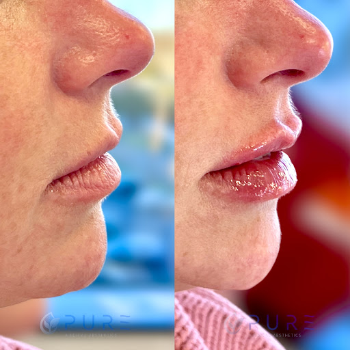 PURE Medical Aesthetics