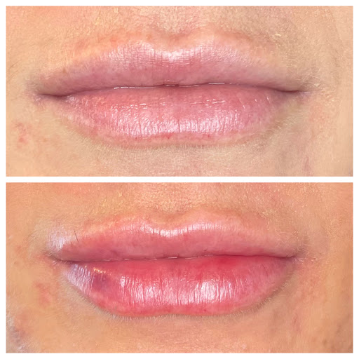 Bella Derma Medical Aesthetics & Wellness